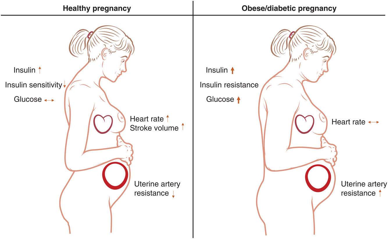 Prenatal Care in Diabetic Pregnancies - Risks and Prevention in Diabetic Pregnancies